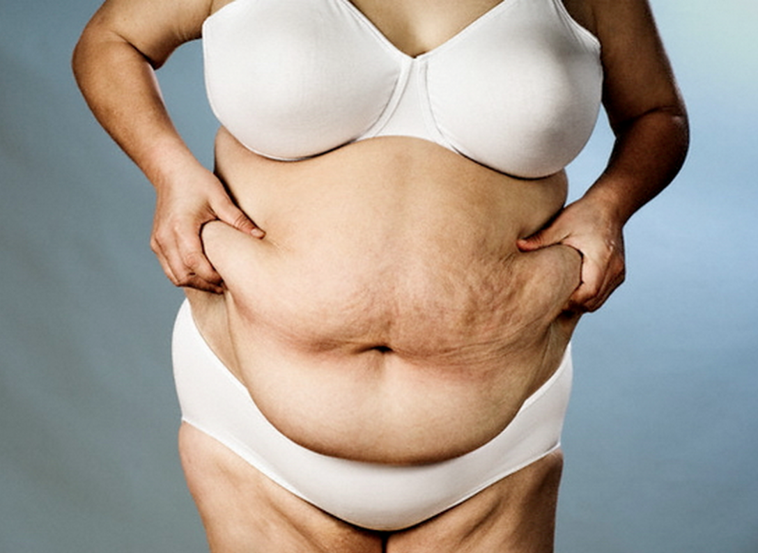 Ожирение осложняет половую жизнь